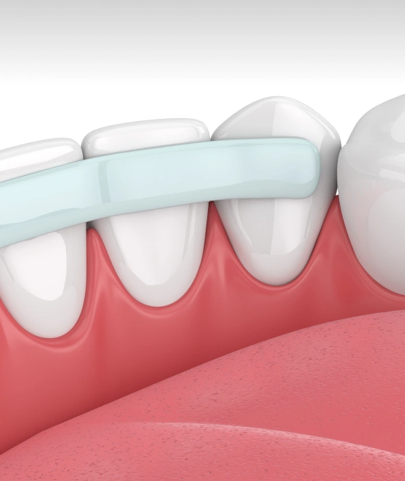 Toothbrush cleaning white teeth and healthy pink gums in close-up dental illustration.
