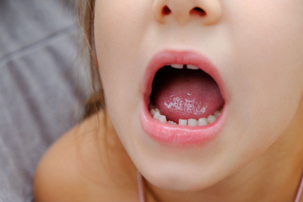 Little girl with a broken tooth